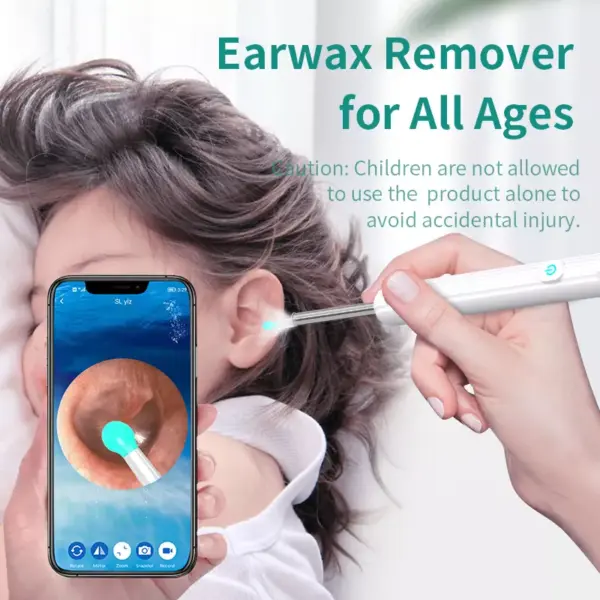 Smart Visual Ear Otoscope Endoscope Wax Removal Tool