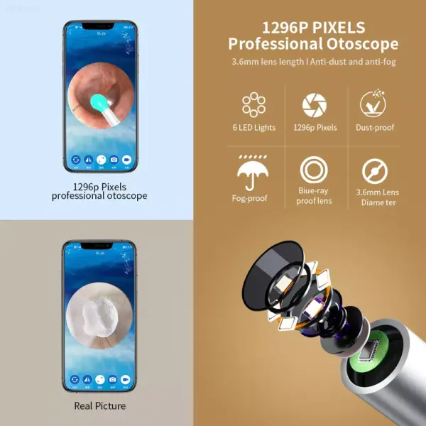 Smart Visual Ear Otoscope Endoscope Wax Removal Tool